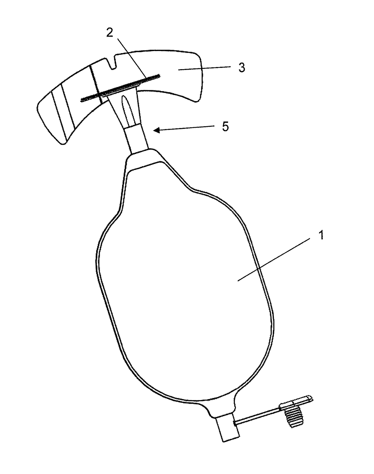 Incontinence device with atmospheric equilibrium valve assembly