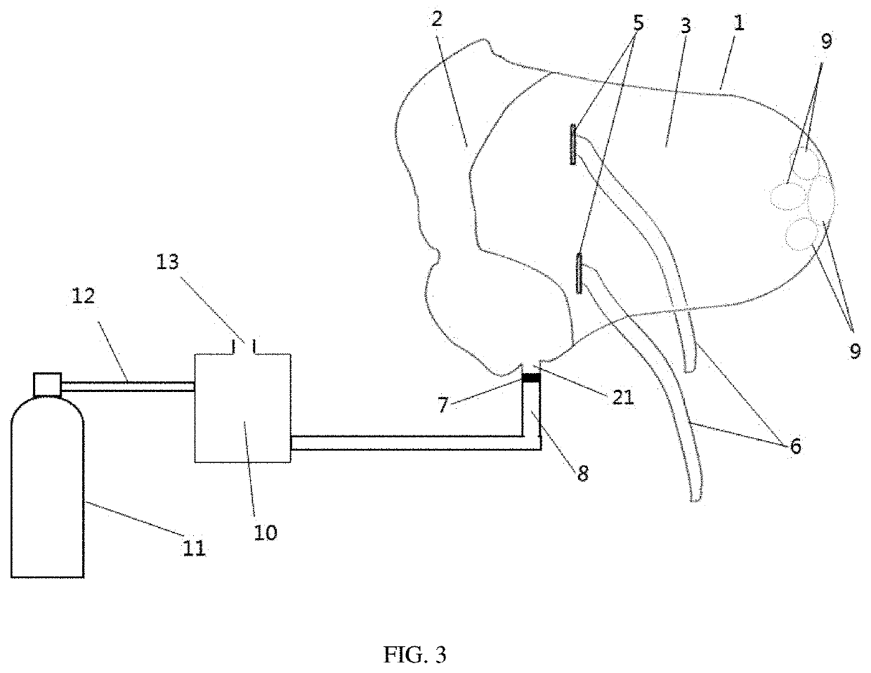 Gas inhalation device with constant concentration of gas entering respiratory tract and without respiratory resistance