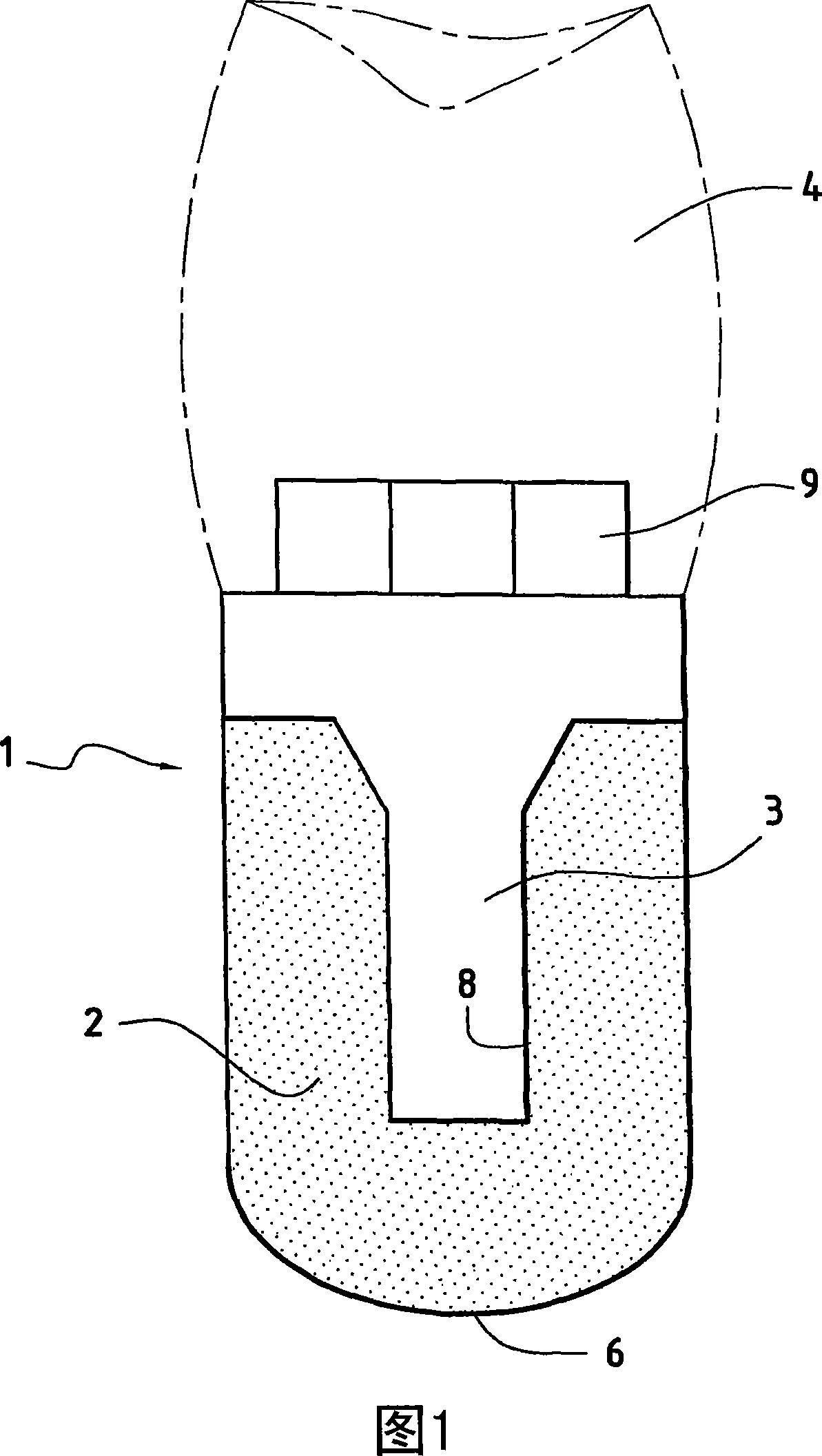 Dental implant comprising a porous trabecular structure