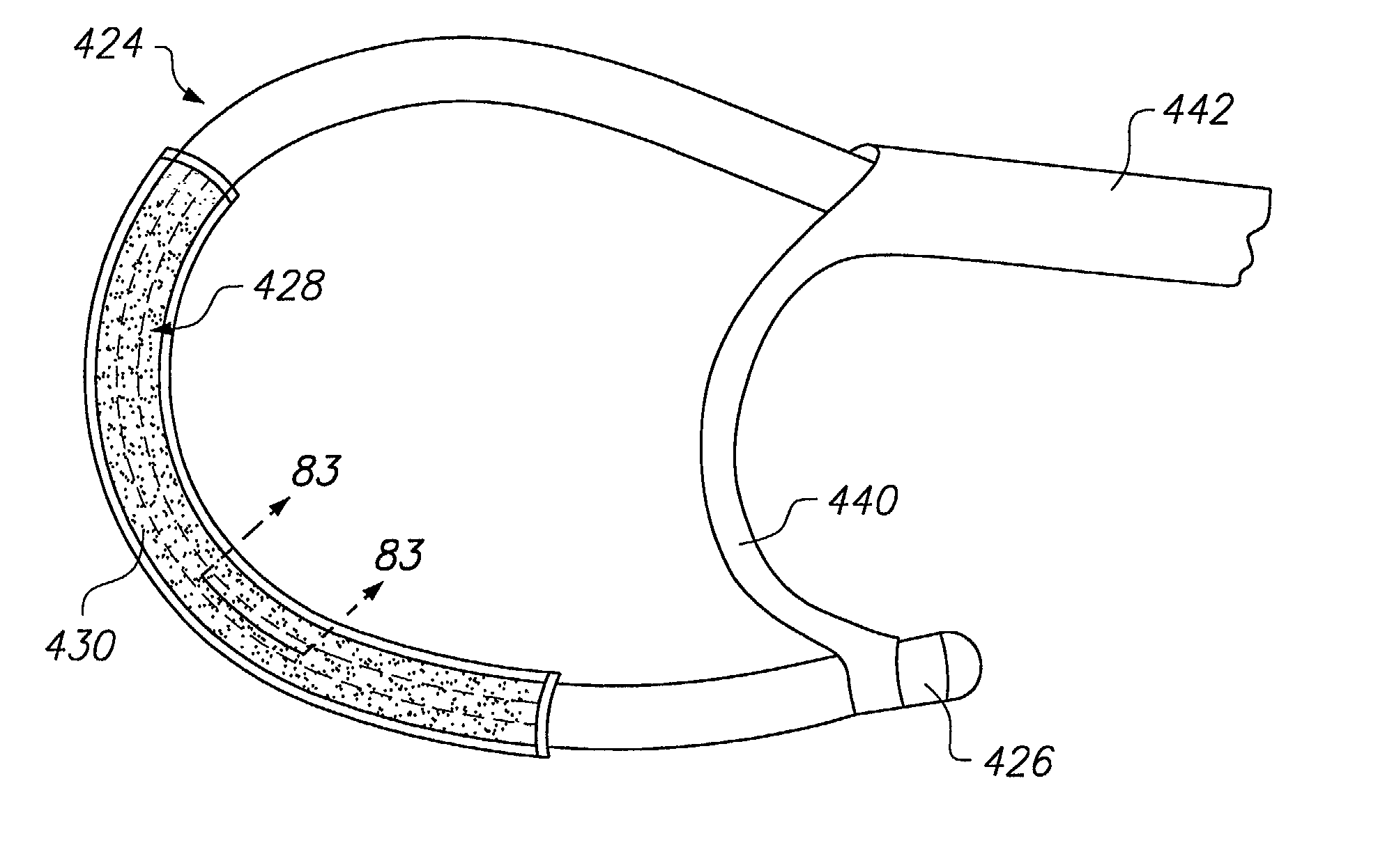 Loop structures for supporting multiple electrode elements