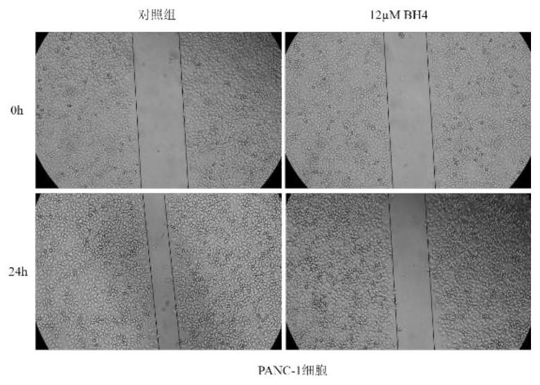 Promoter for reducing malignant phenotypes of pancreatic cancer cells, pharmaceutical composition and application thereof