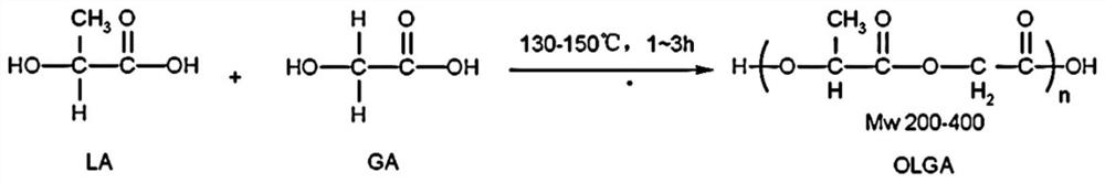 Drug-loaded degradable absorbable medical suture thread and preparation method thereof