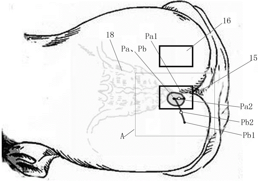 Medical sacral nerve puncture localizing and guiding system