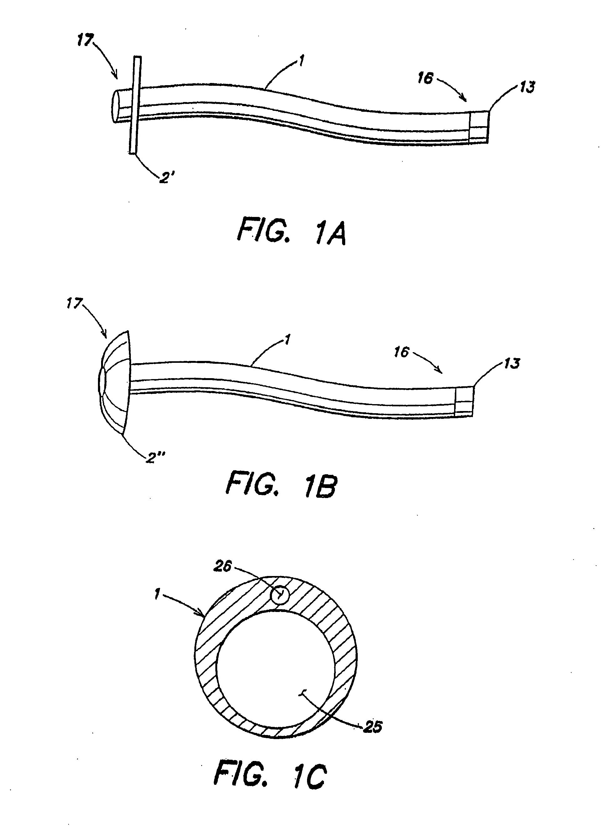 Shunt apparatus for treating obesity by extracting food