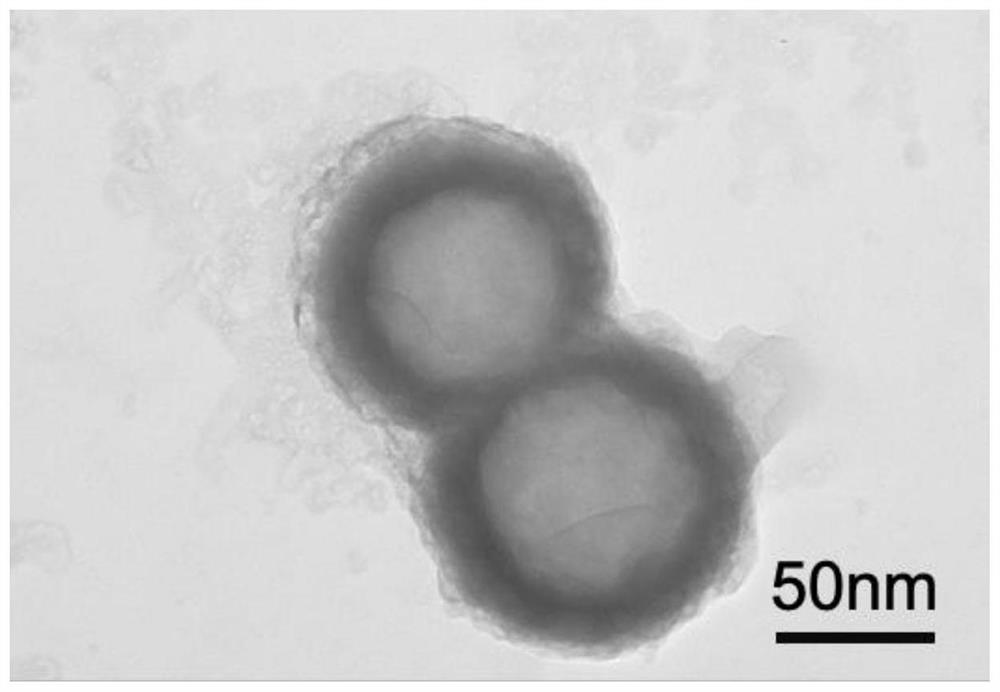 Self-oxygen-supply targeted bionic nuclear membrane structure nano-composite as well as preparation method and application thereof