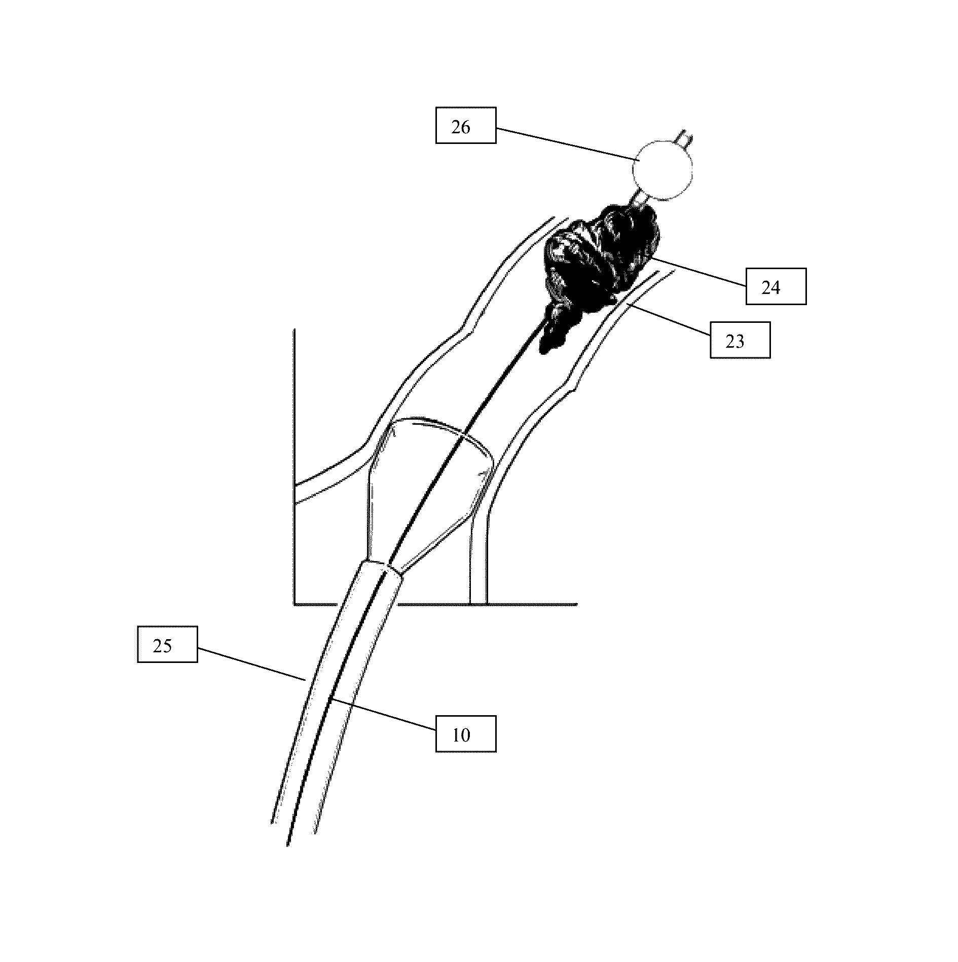 Systems and methods for removing and fragmenting undesirable material within a circulatory system