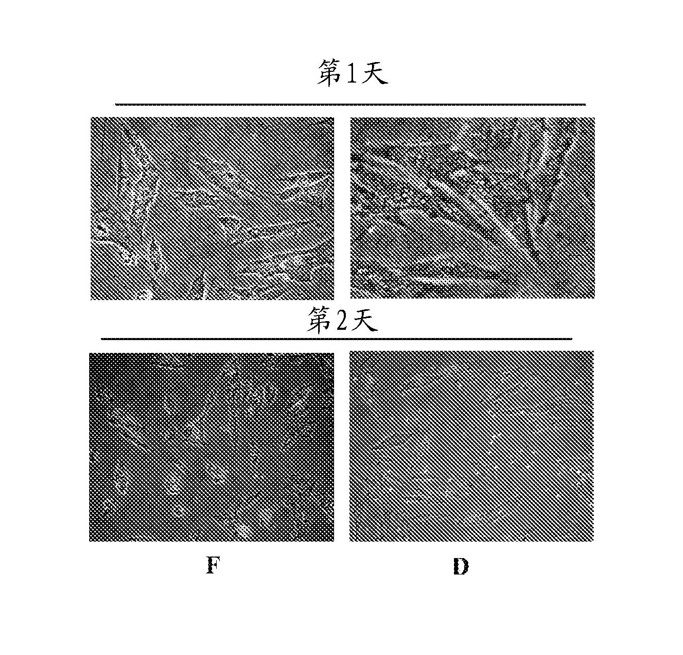 Method and composition for restoration of age-related tissue loss in the face or selected areas of the body