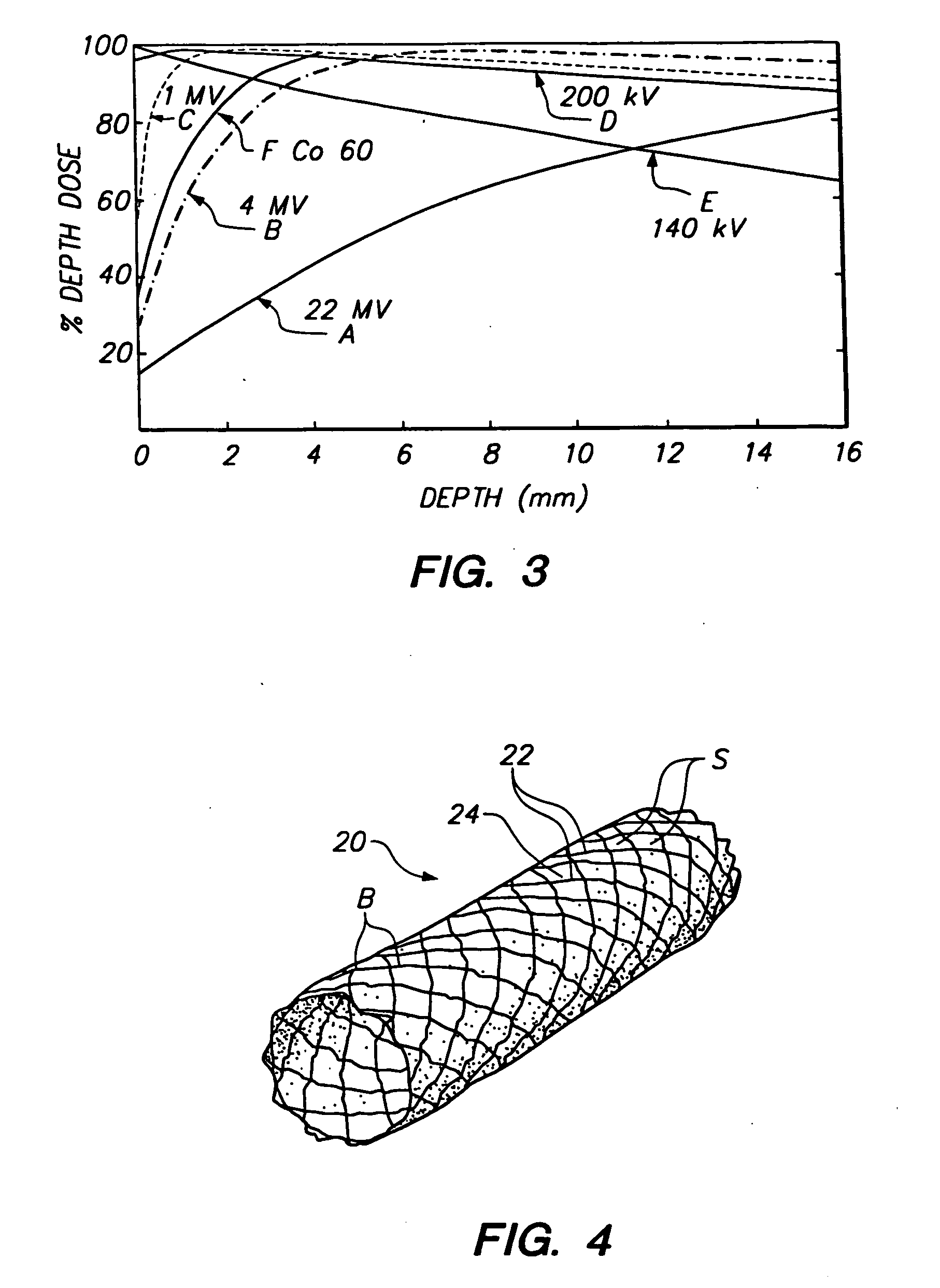 Stent for neutron capture therapy and method of manufacture therefor