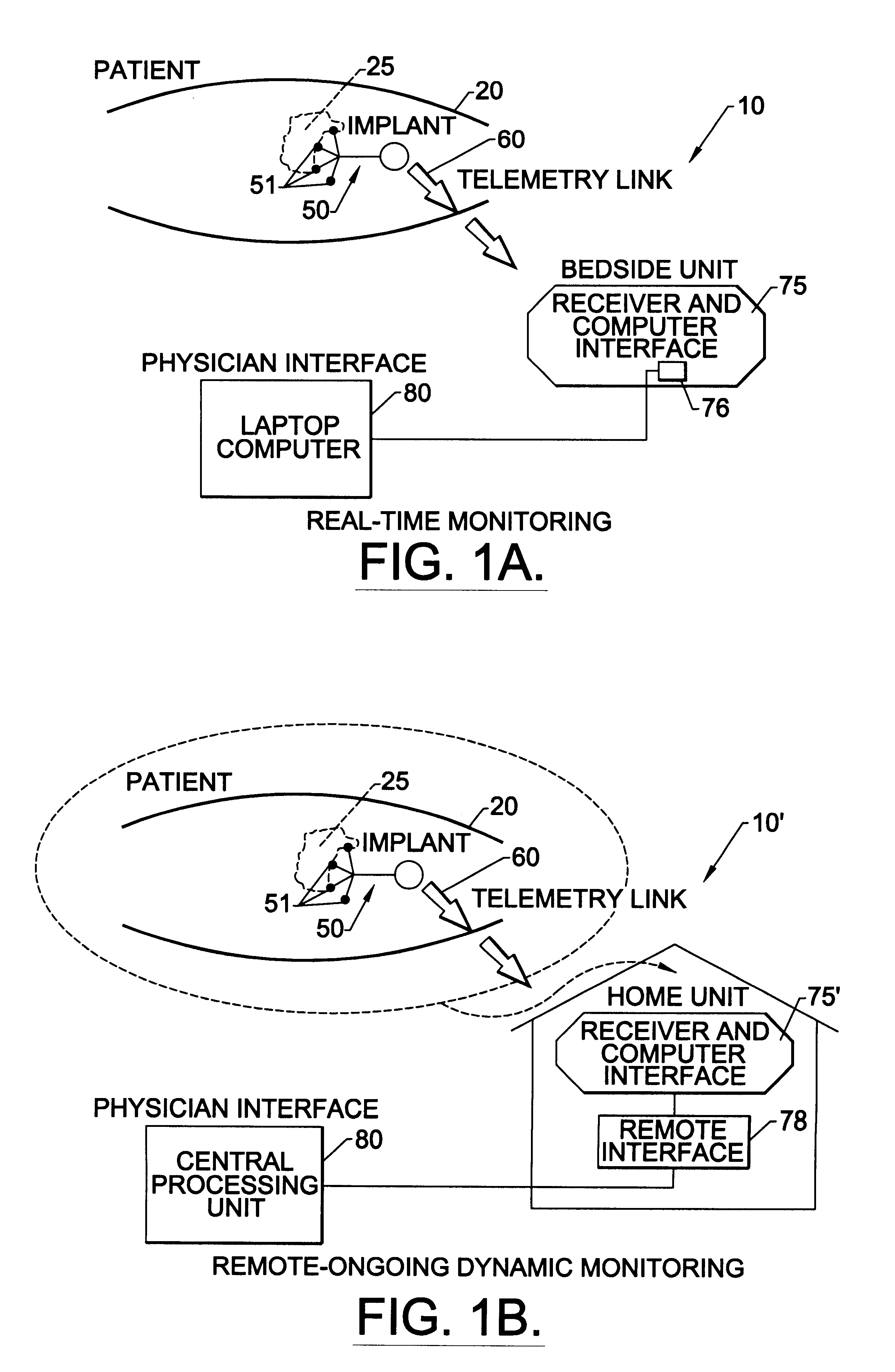 Methods, systems, and associated implantable devices for dynamic monitoring of physiological and biological properties of tumors