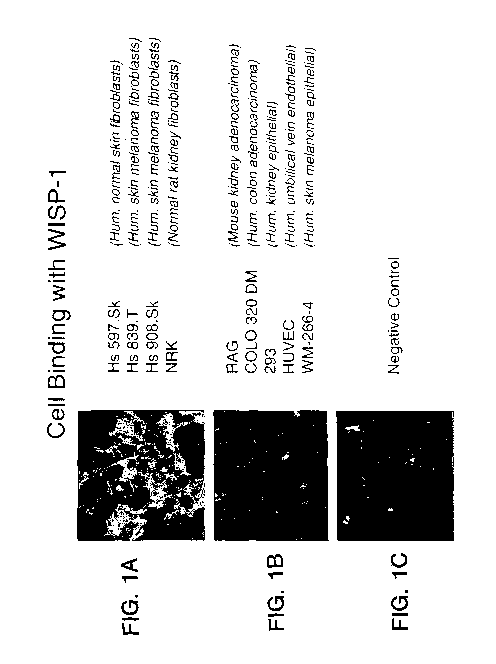 Methods of treatment using wisp polypeptides