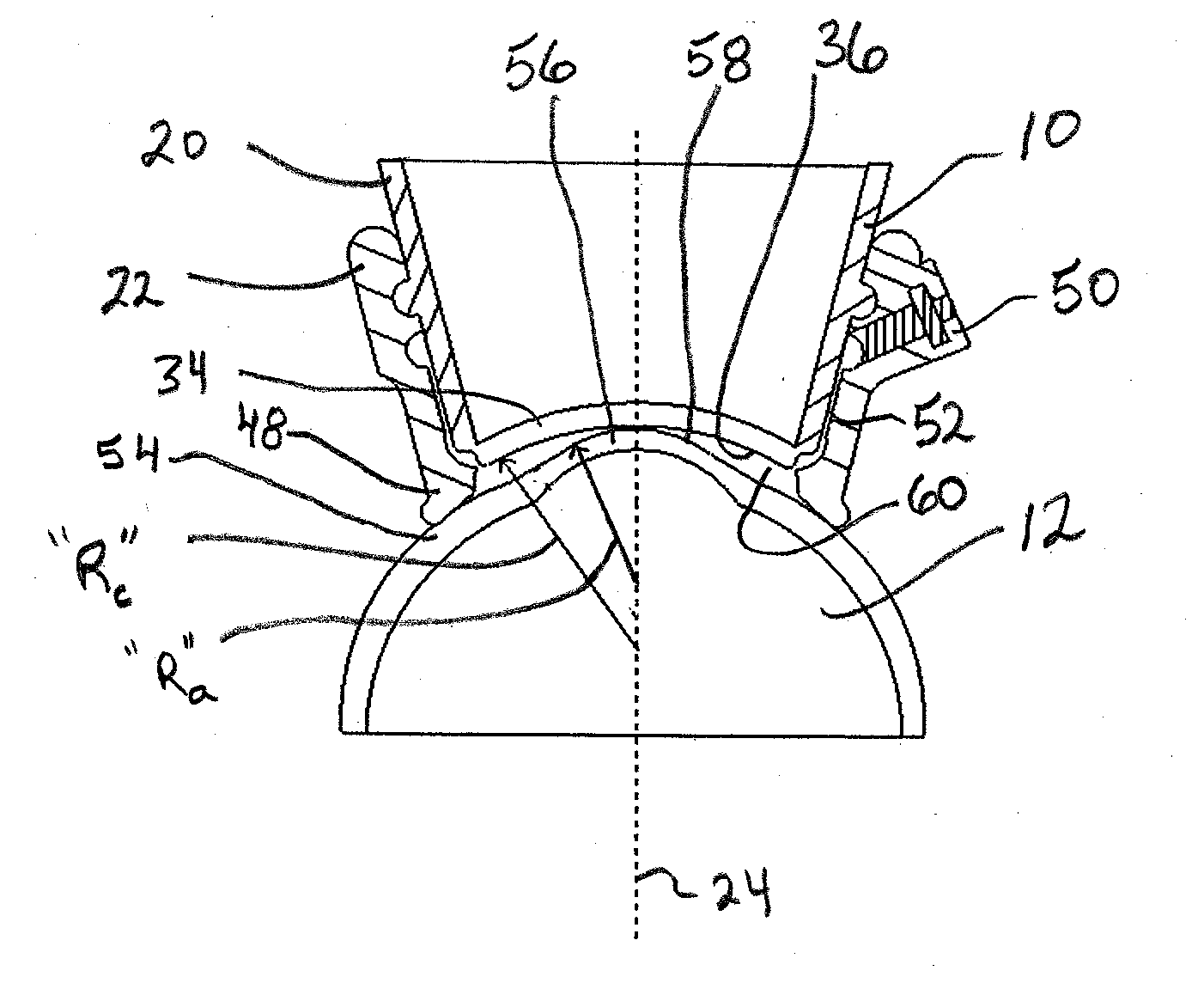 System and Method for Docking a Cornea with a Patient Interface Using Suction