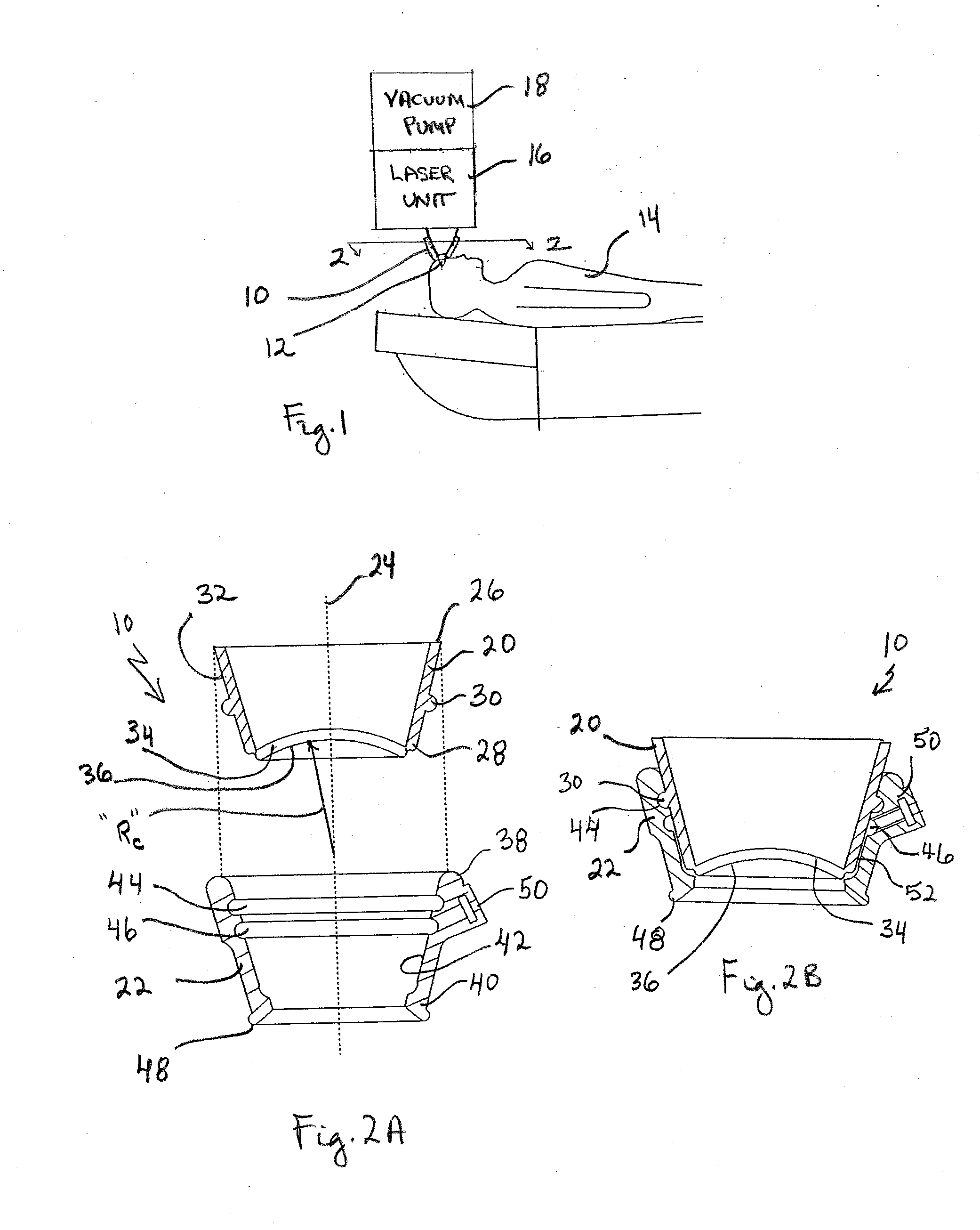 System and Method for Docking a Cornea with a Patient Interface Using Suction