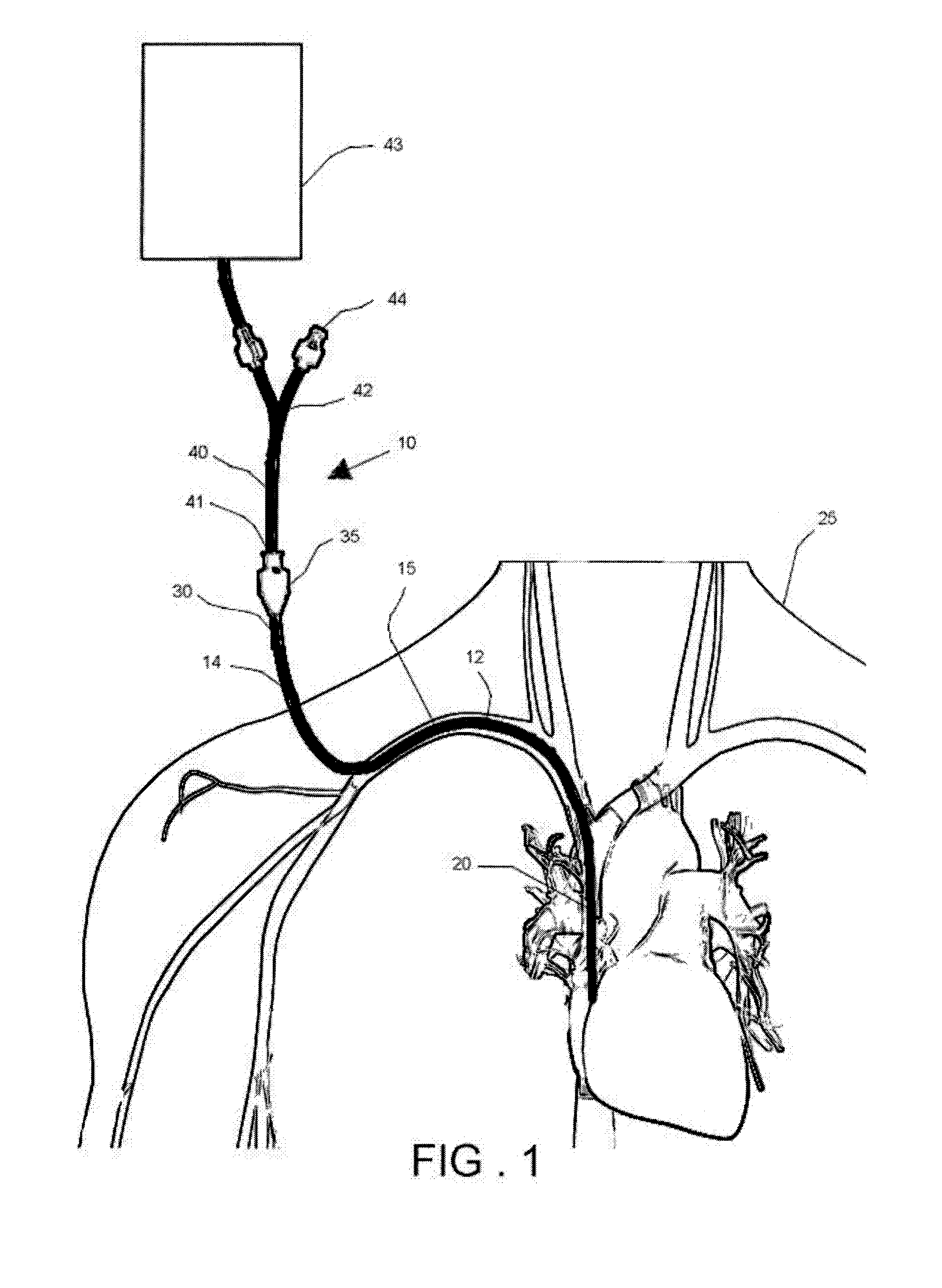 Pressure activated proximal valves