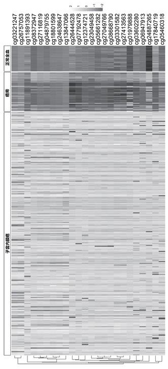 TMEM101 Gene Methylation Detection Kit for Early Screening of Endometrial Cancer in Human Peripheral Blood Circulating Tumor DNA