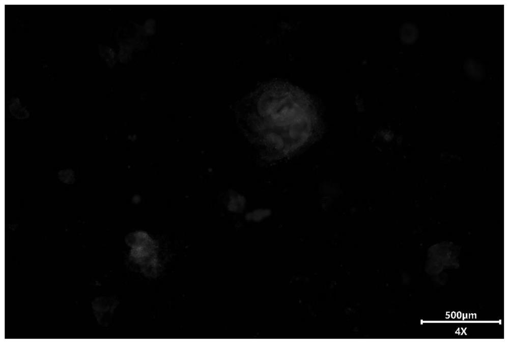 A kind of composition, culture medium and application for siRNA transfection 3D organoid