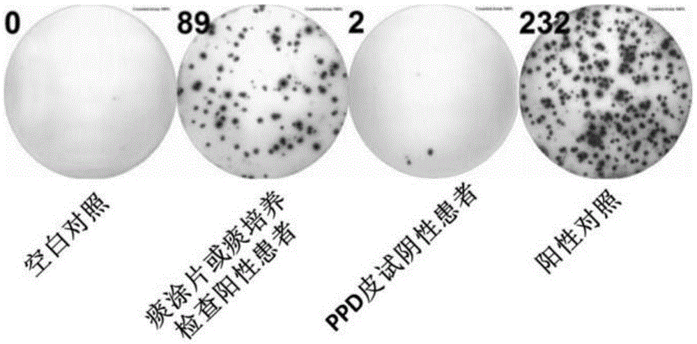 Mixed polypeptide for producing tuberculosis associated cell factors by inducing peripheral blood mononuclear cell