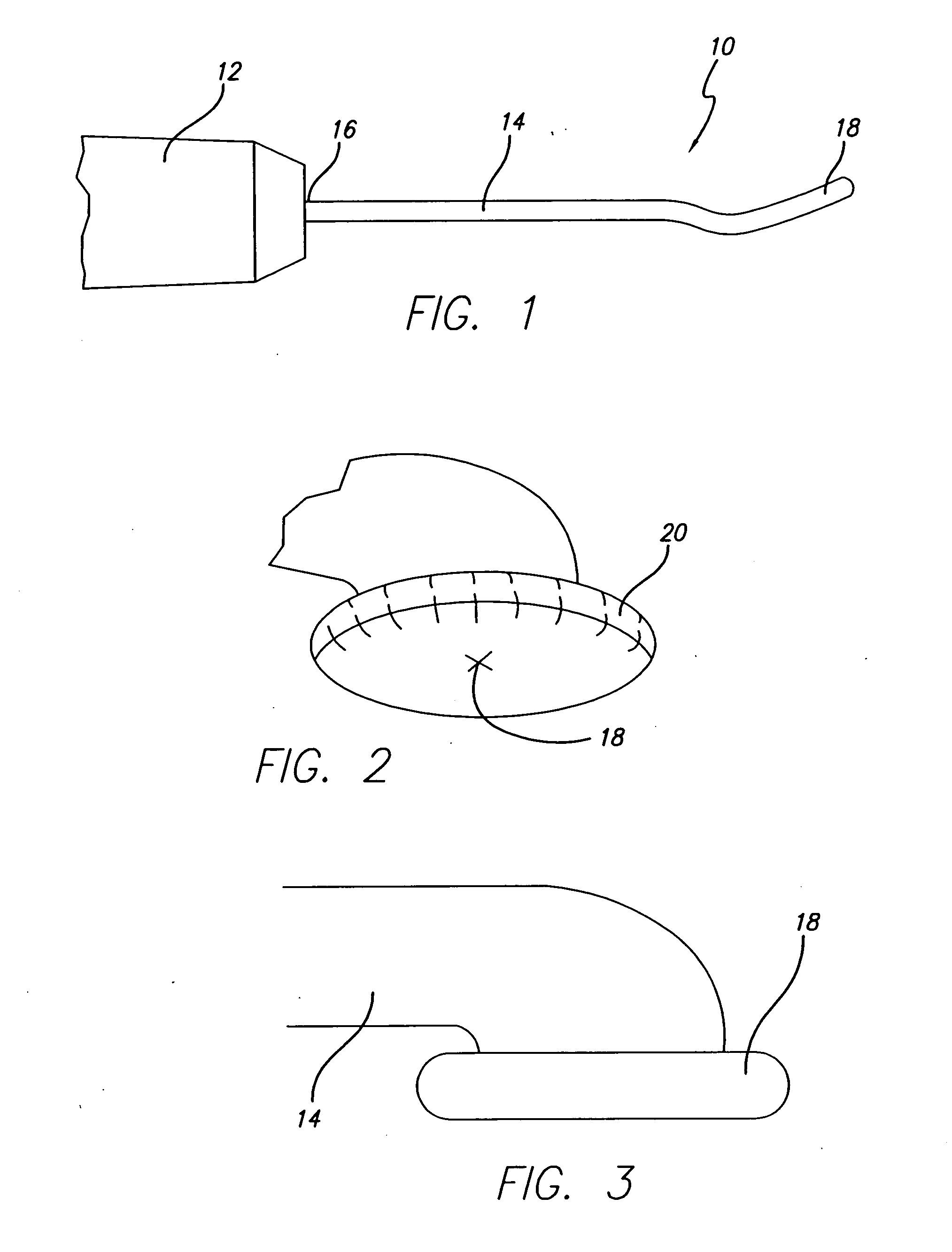 Method and apparatus for controlled contraction of soft tissue