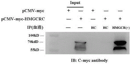 Nonradioactive detecting methods of inflammatory myopathy HMGCR (3-hydroxy3-methylutaryl coenzyme A reductase) autoantibody and application