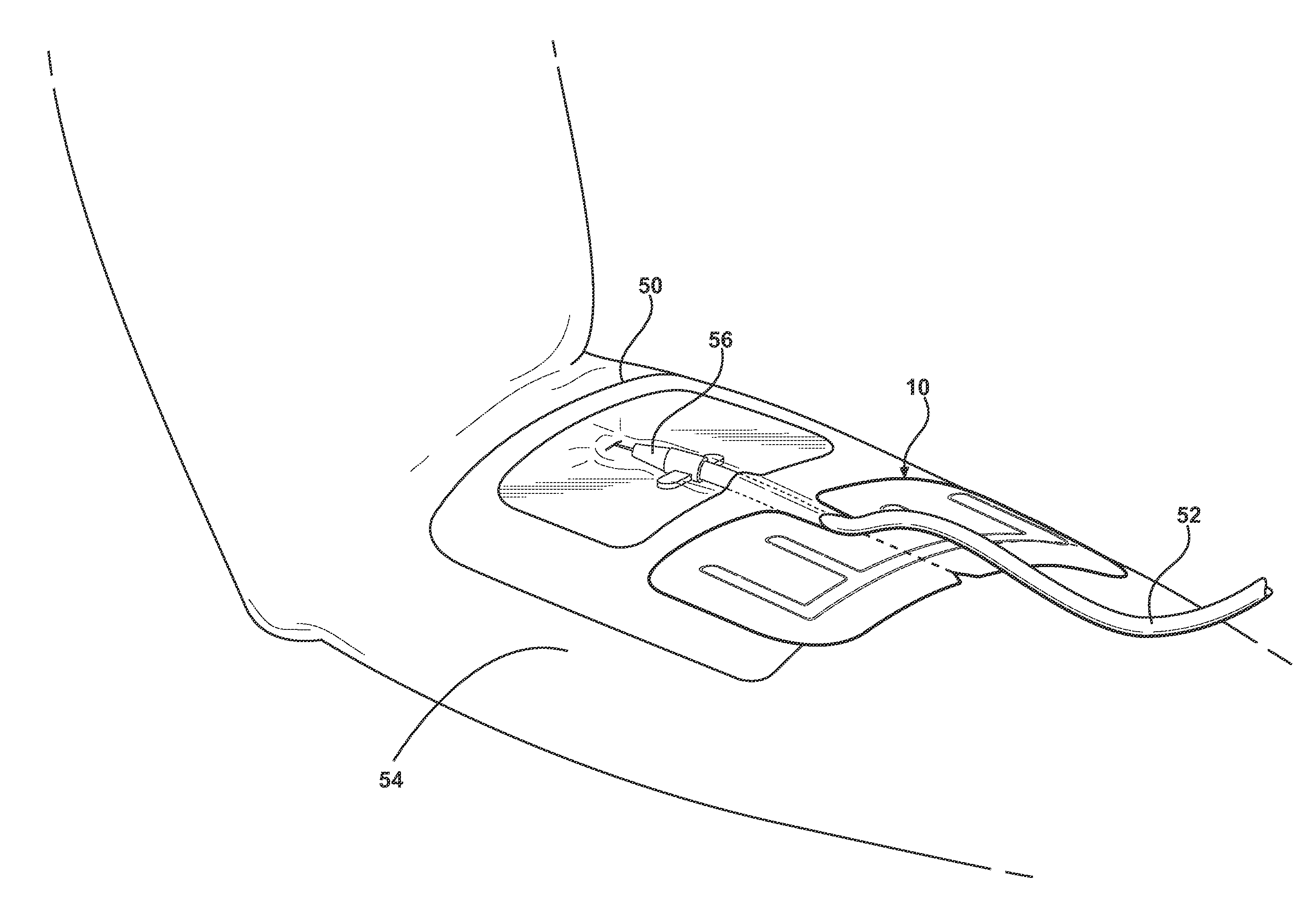 Reinforced closure anchor