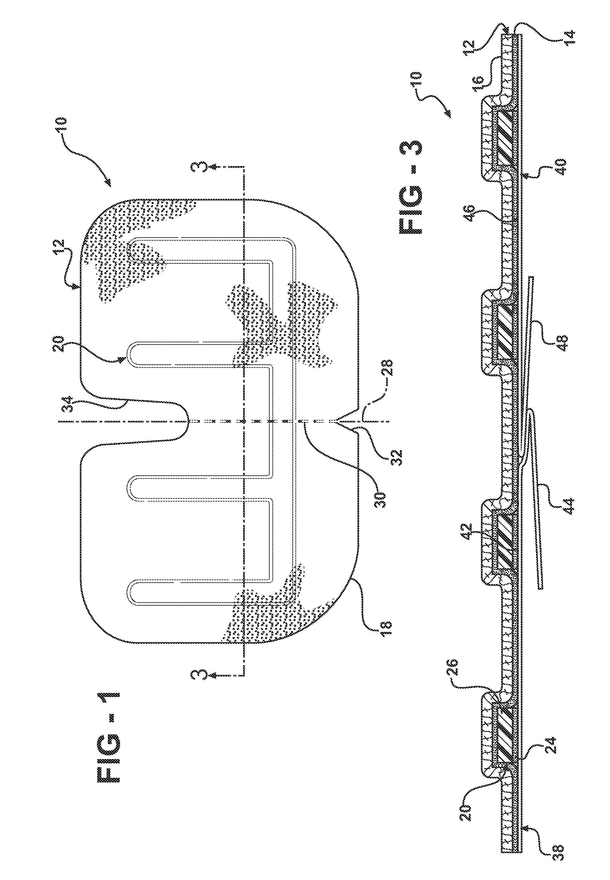 Reinforced closure anchor