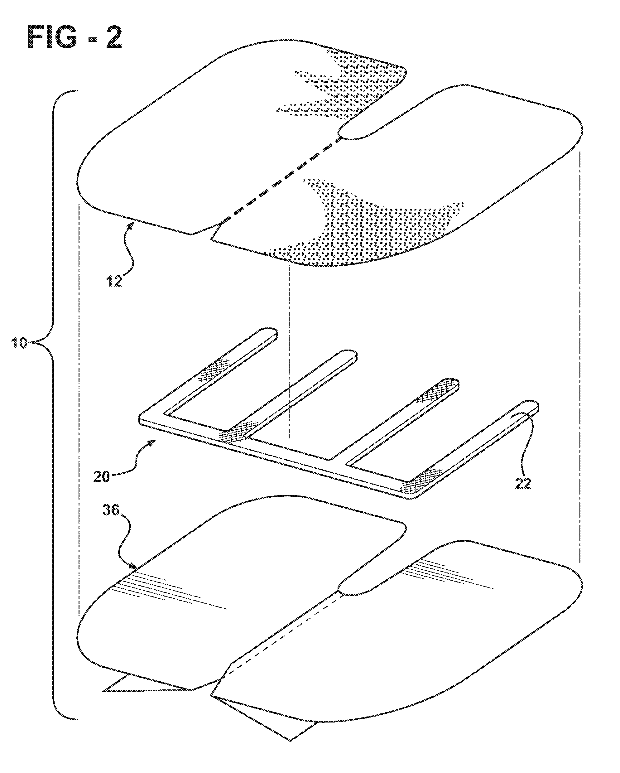 Reinforced closure anchor