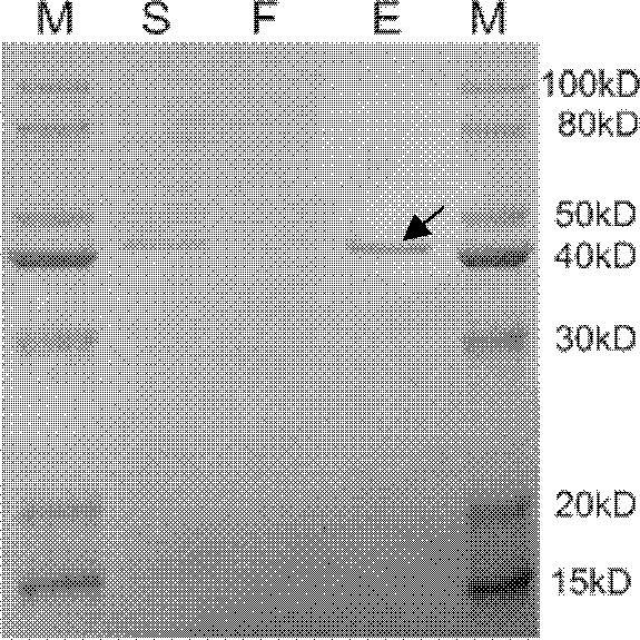 Method of using pichia yeast expression system to produce German cockroach allergenic Blagarg protein