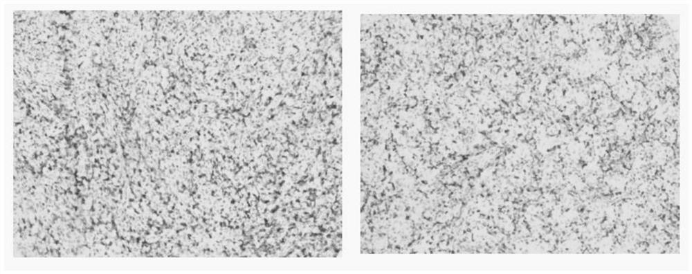 Anti-cd5 protein monoclonal antibody and its cell line, preparation method and application