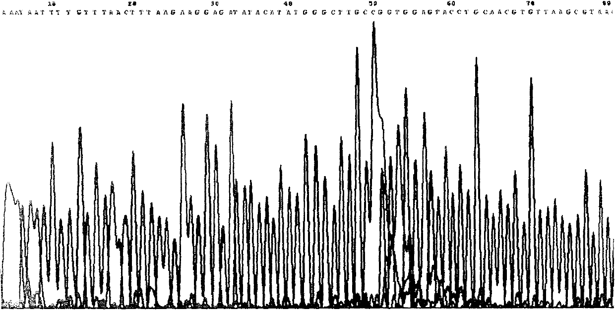 Recombinant tubercle bacillus antigen poly epitope peptide and its constructing method and use