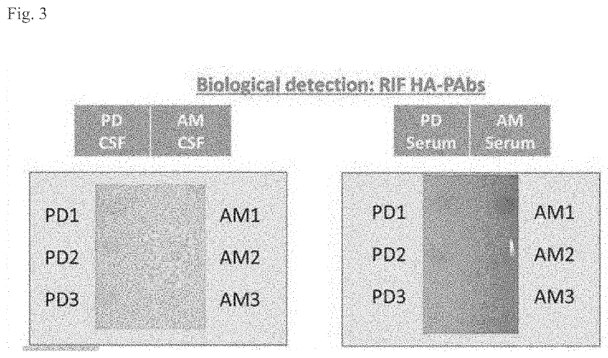 Nano-theranostics for parkinson's disease