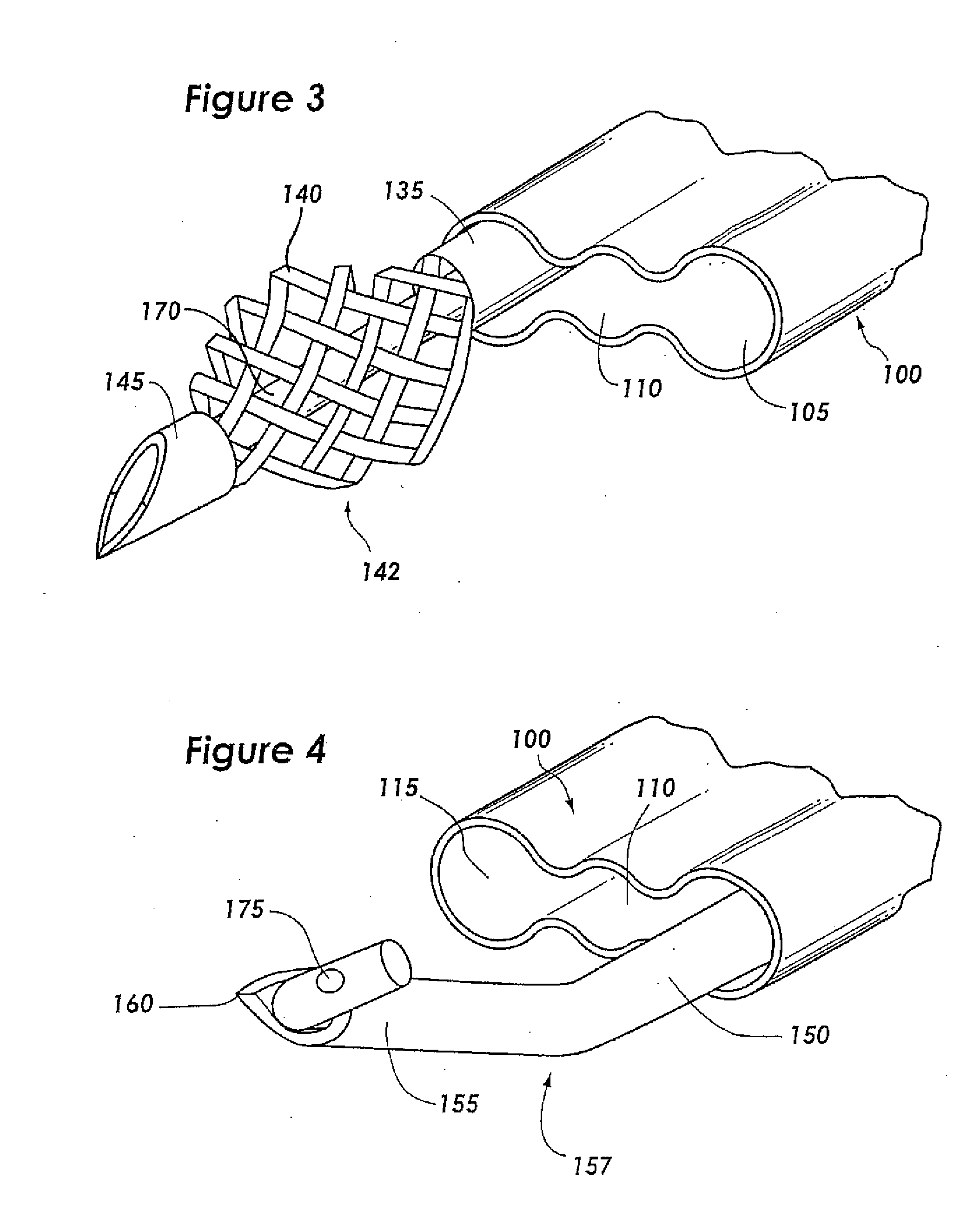 Three-needle closure device