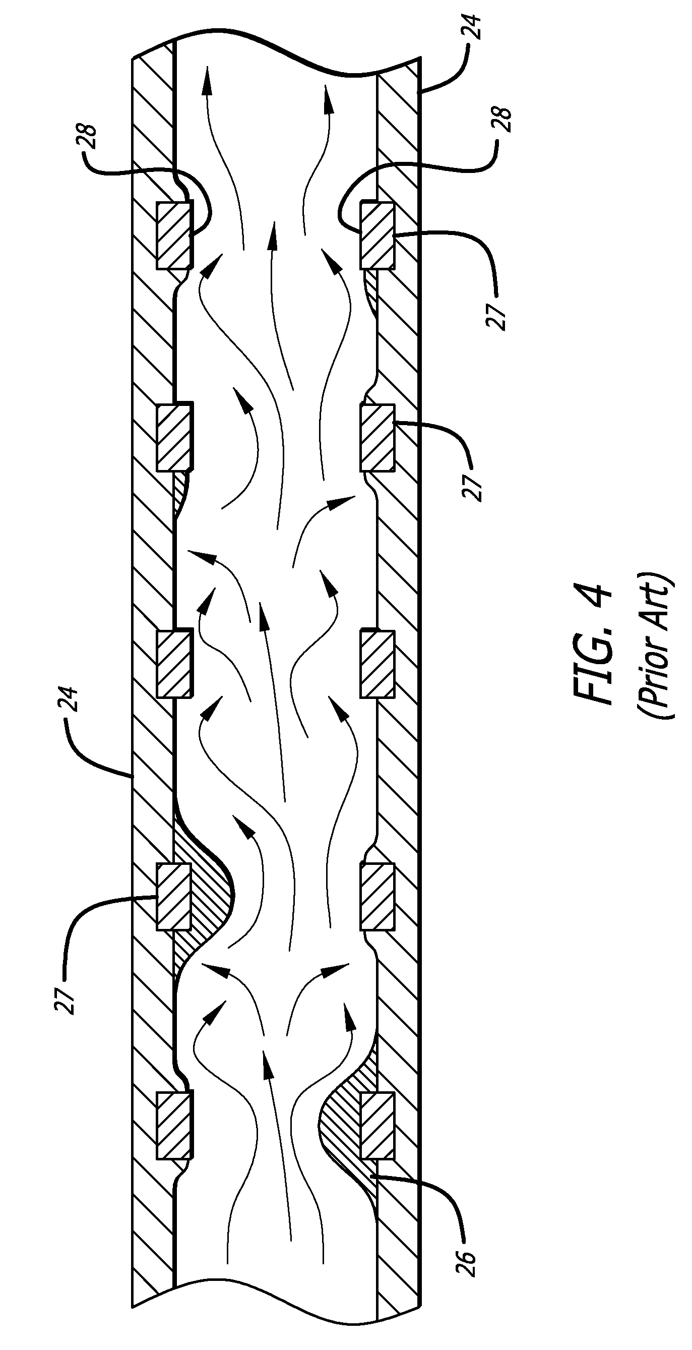 Electrochemical formation of foil-shaped stent struts