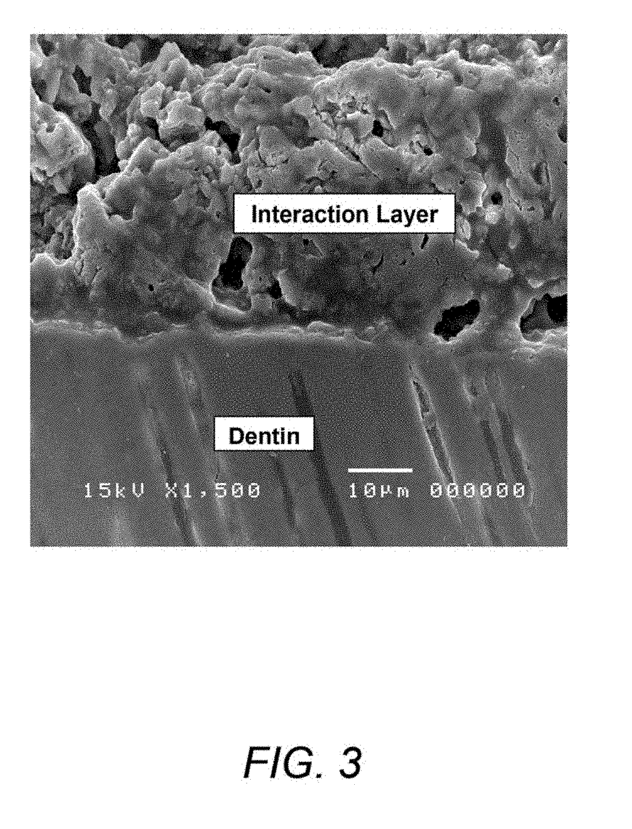 Borate bioactive glass and methods of use for dentin and enamel restoration