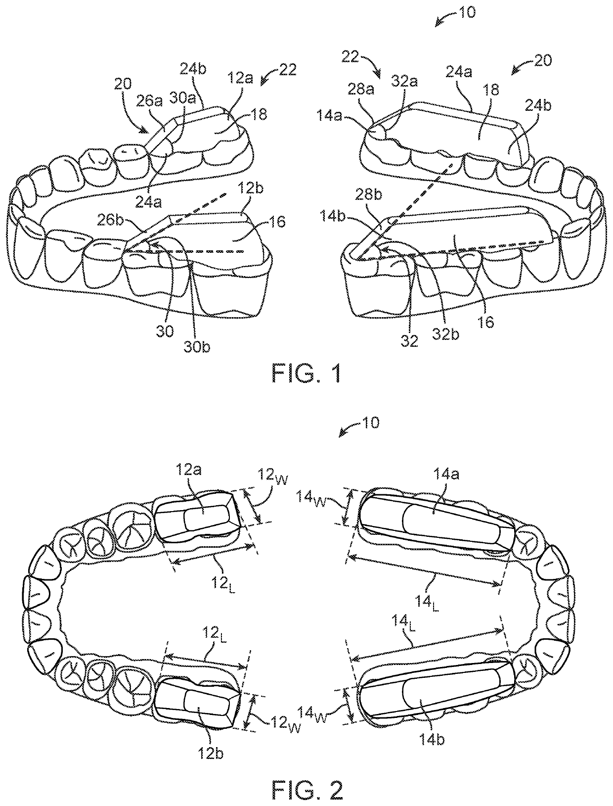 Combined orthodontic movement of teeth with airway development therapy