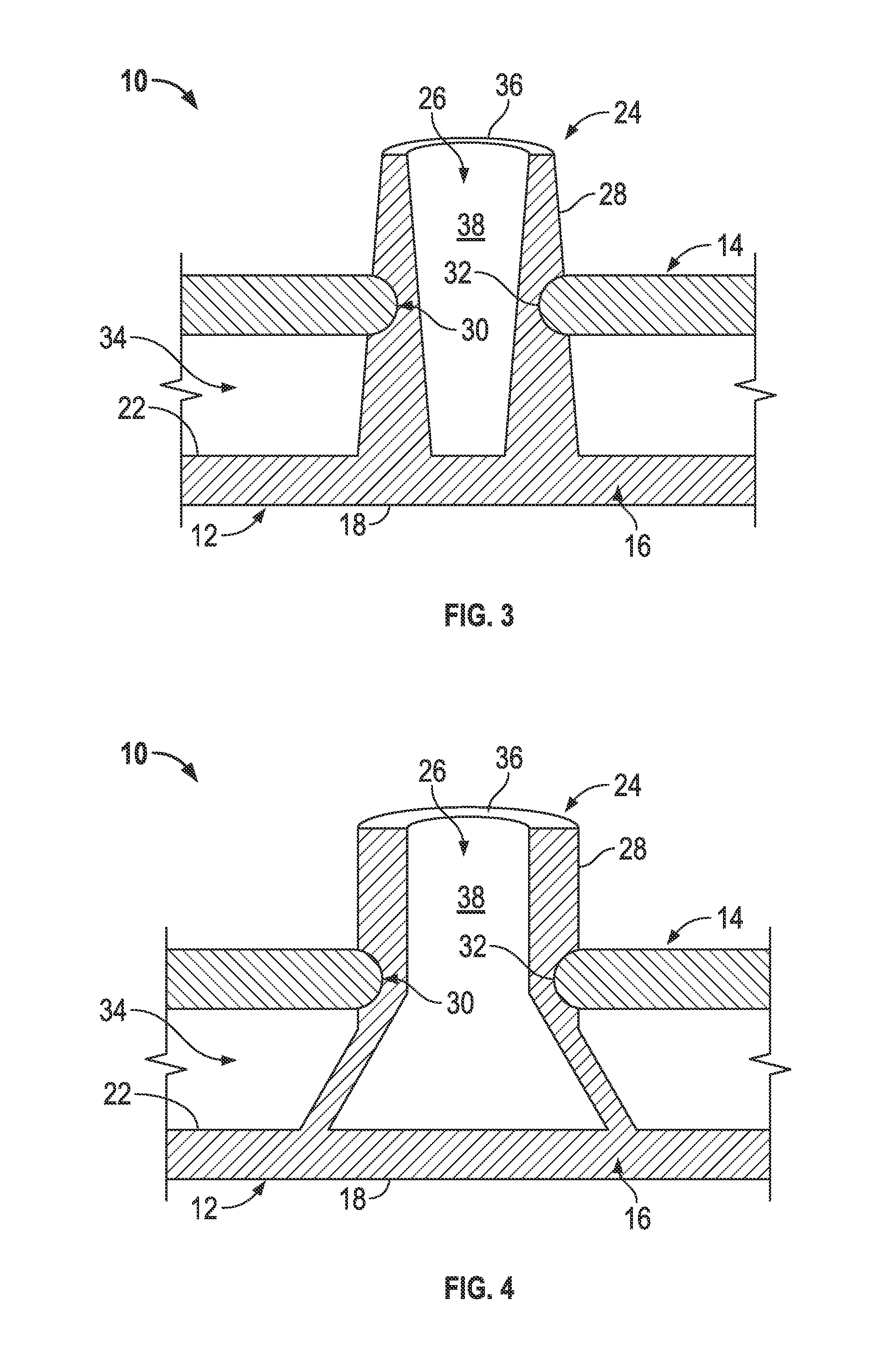 Elastically deformable energy management arrangement and method of managing energy absorption