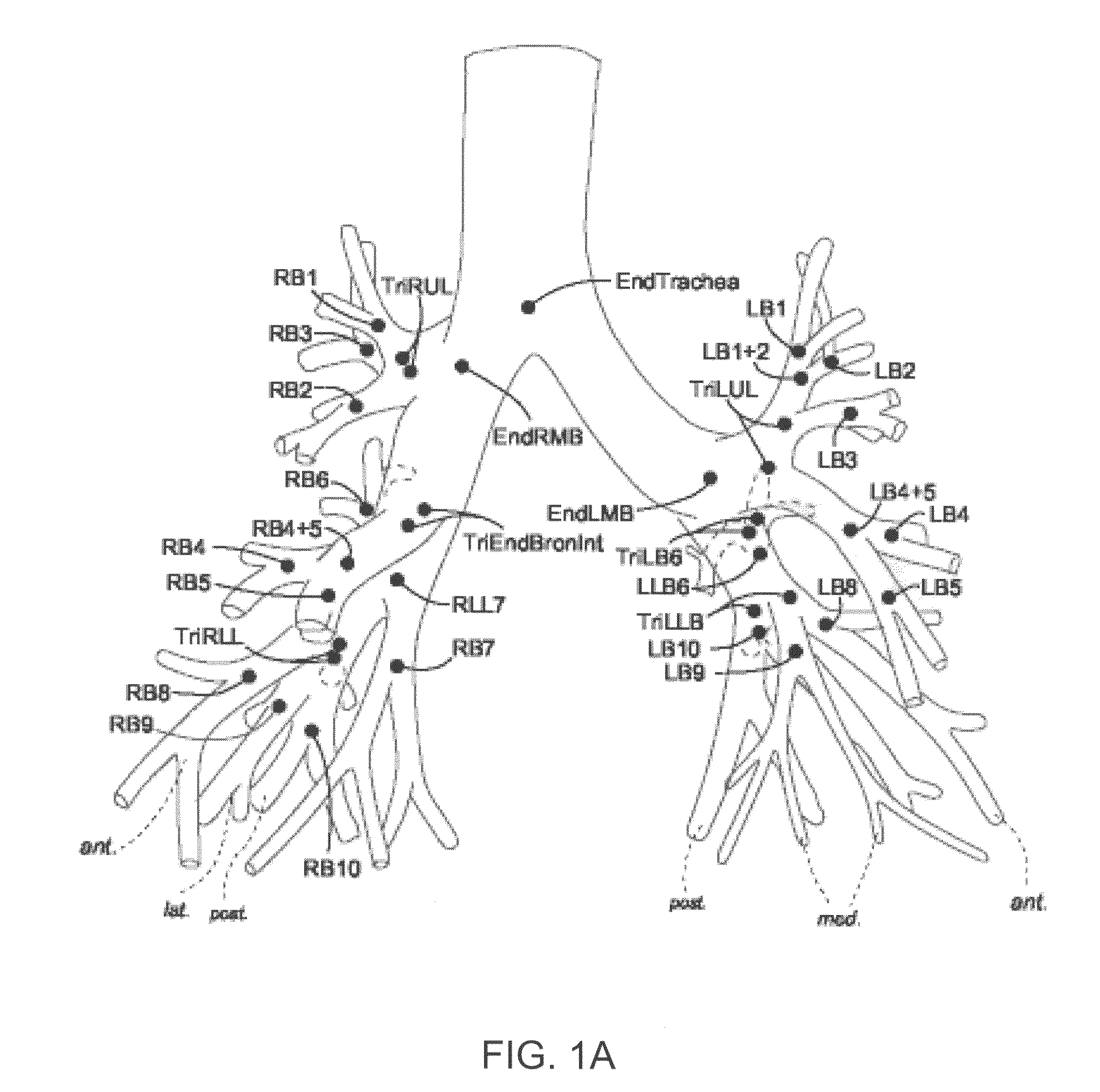 Methods and devices for airway tree labeling and/or matching