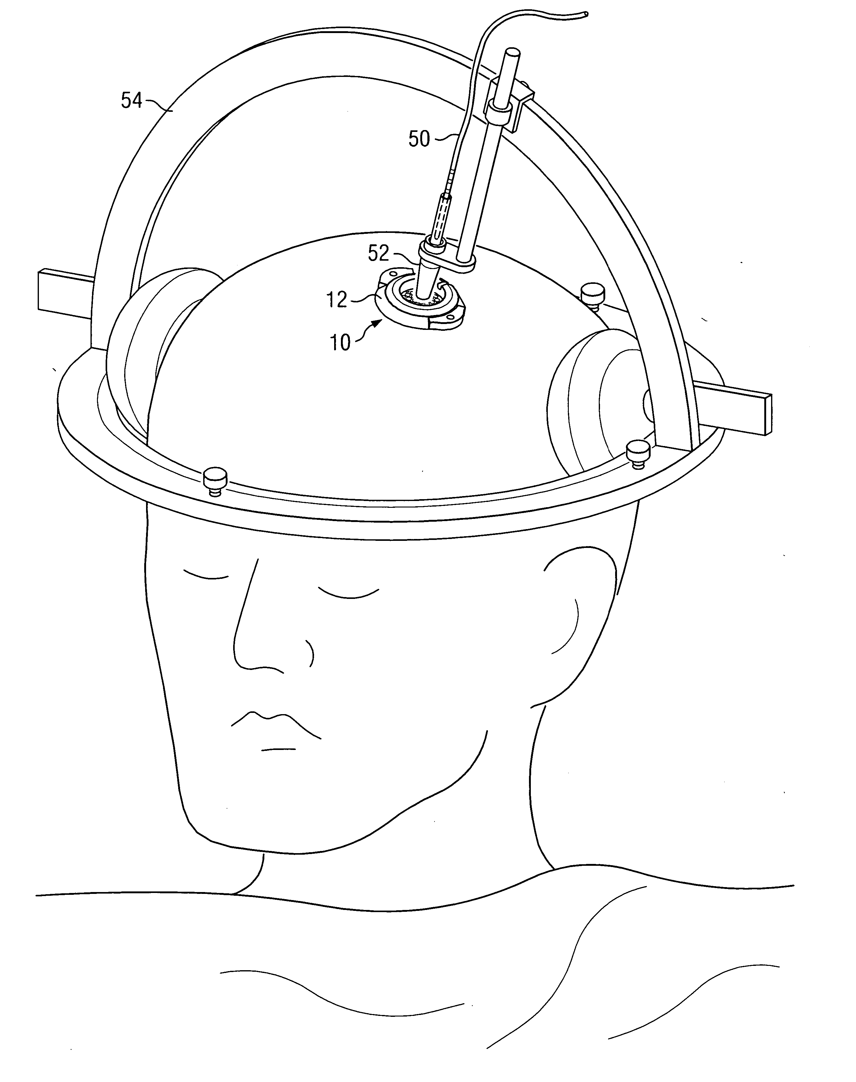 Electrical stimulation system and associated apparatus for securing an electrical stimulation lead in position in a person's brain
