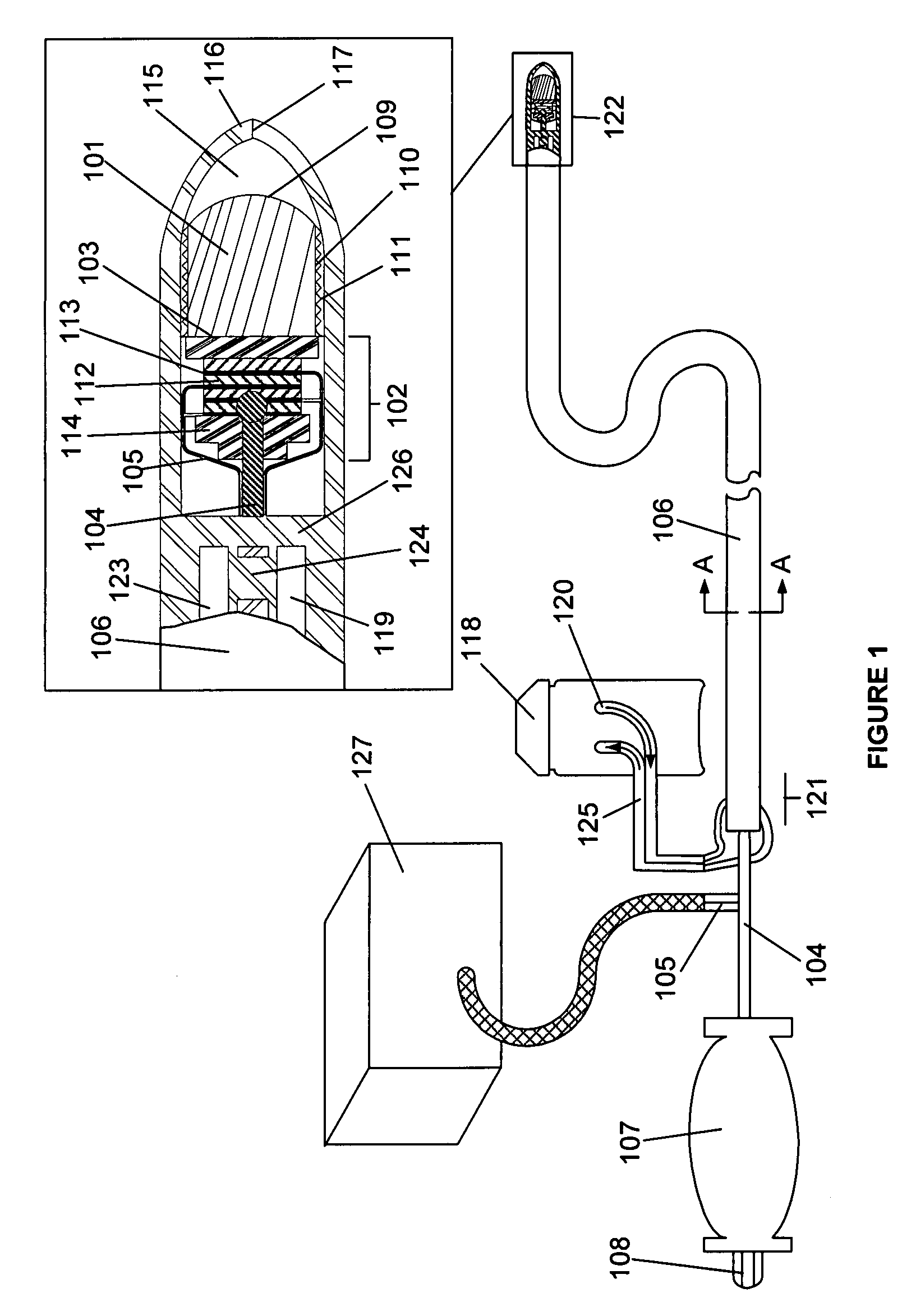 Ablative ultrasonic-cryogenic apparatus
