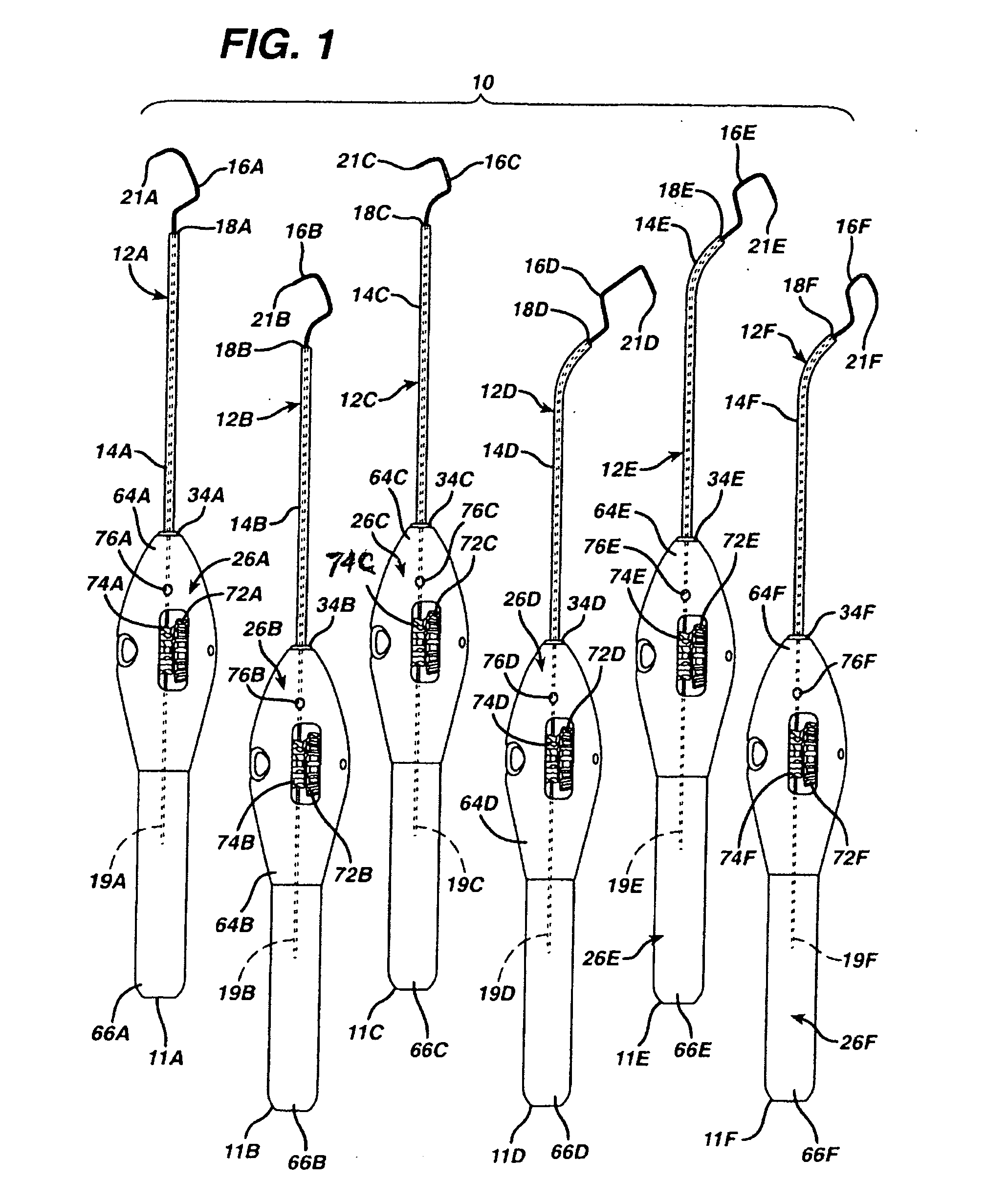 Implant system with sizing templates