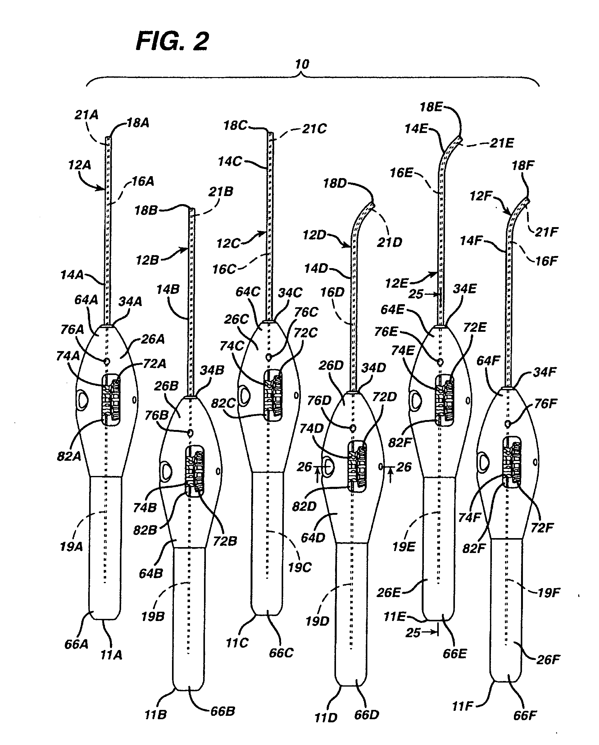 Implant system with sizing templates