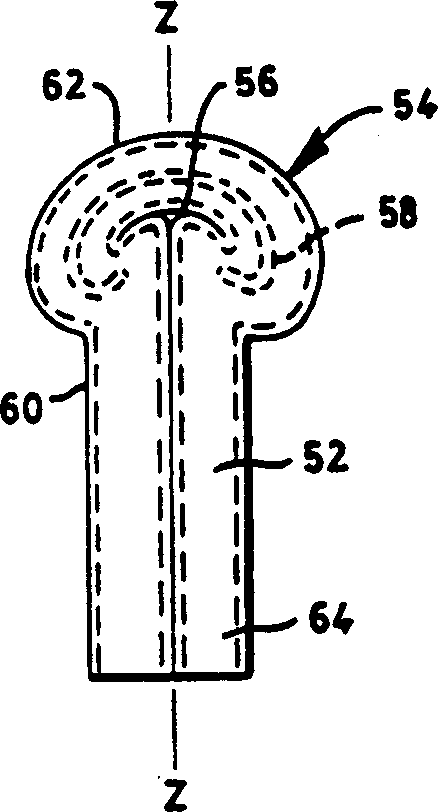Method for alleviating female urinary incontinence