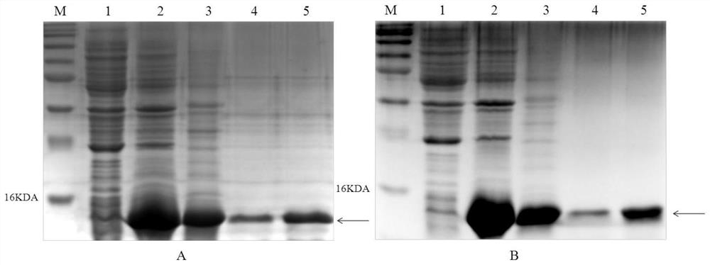 Brain-targeted HIV entry inhibitor polypeptide and application thereof