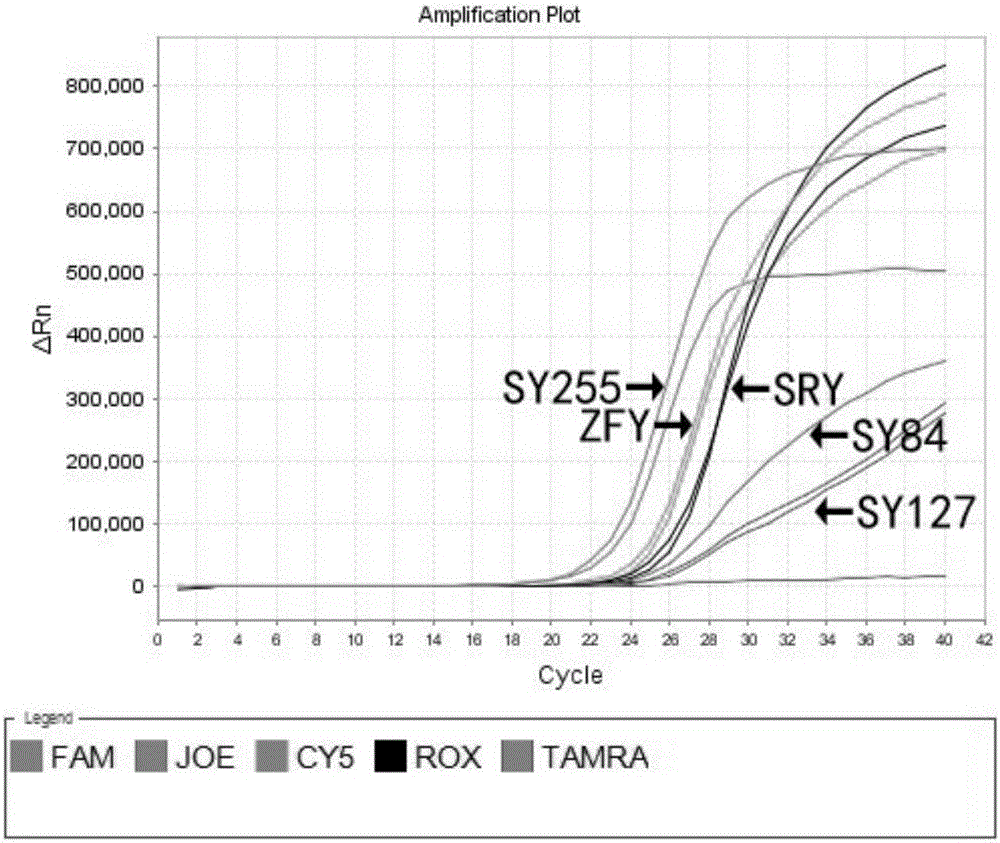 Y chromosome microdeletion detection kit and method