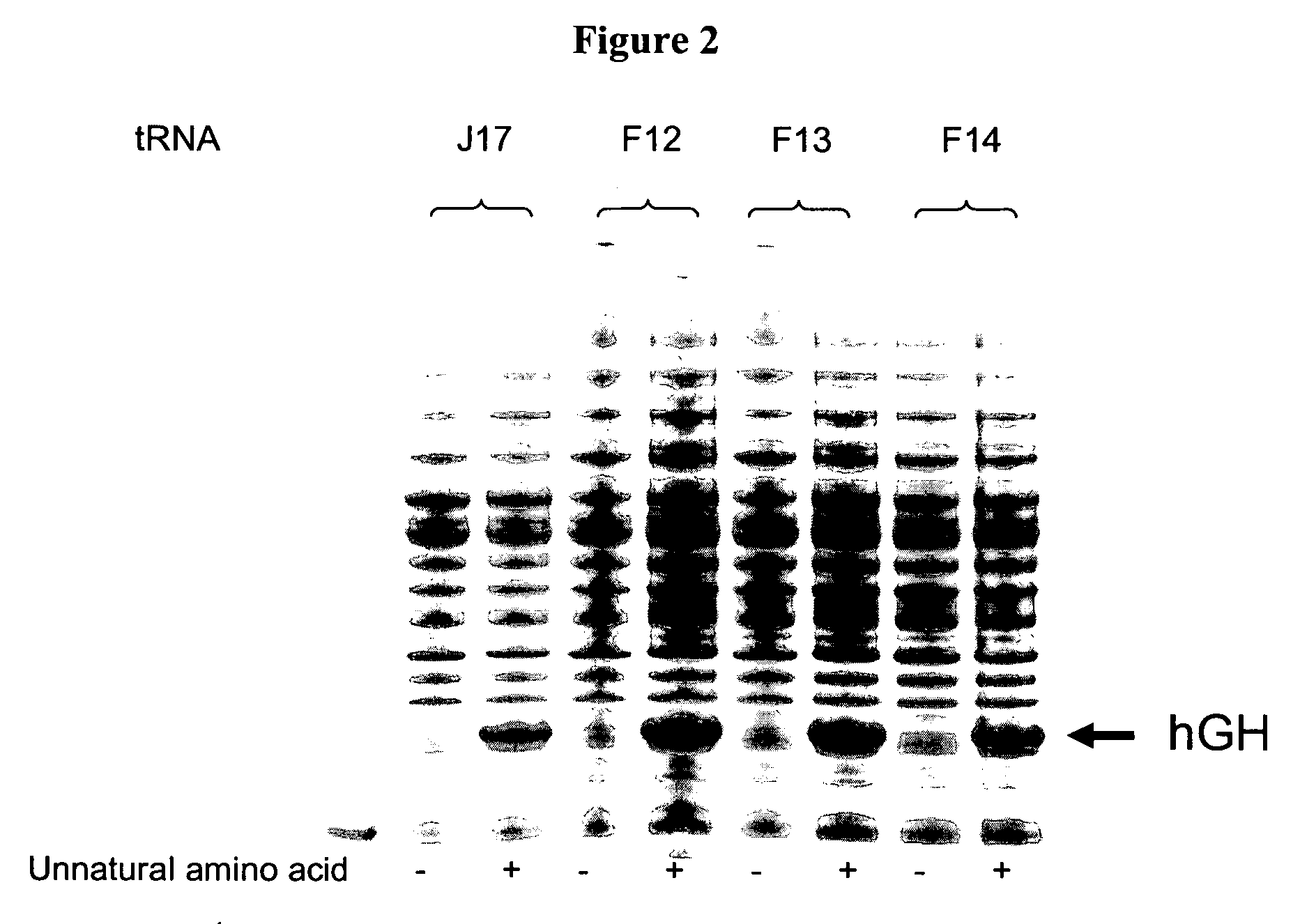 Compositions of aminoacyl-tRNA synthetase and uses thereof