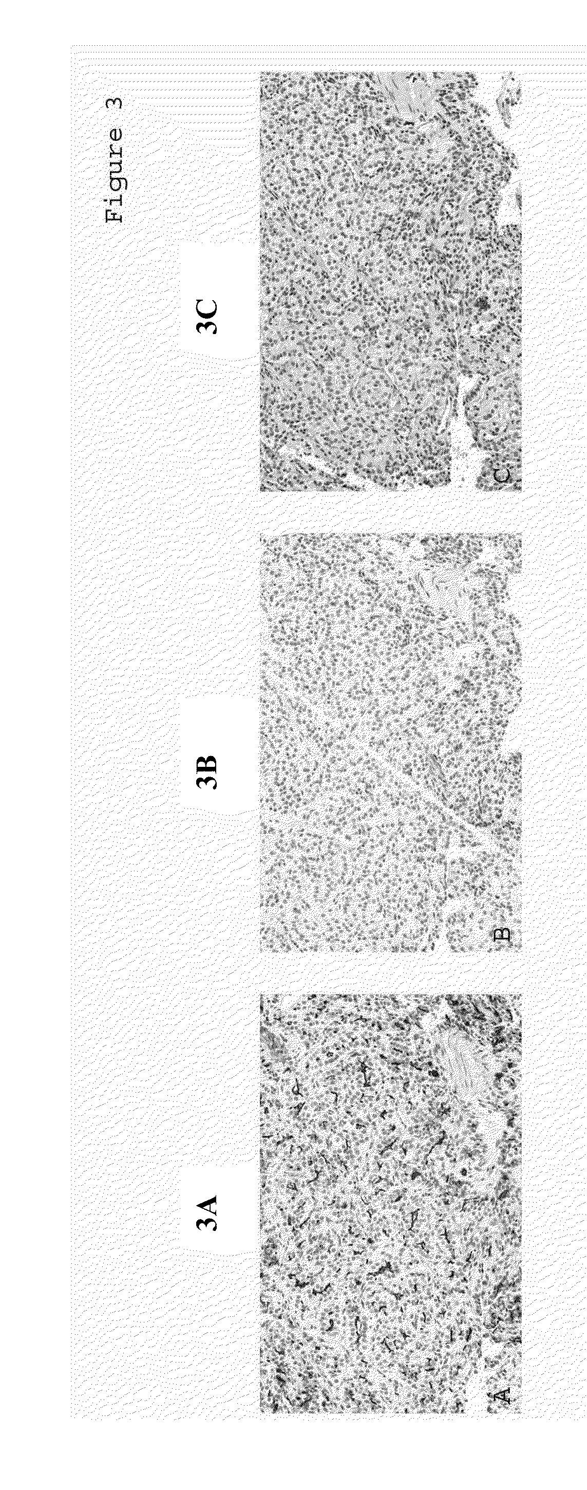Methods for Detecting Tumor Origin Based on MUC1, MUC2, and CK-17 Expression Levels
