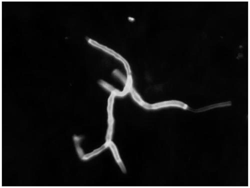 Application of basic chitinase from vibrio in fungus dyeing