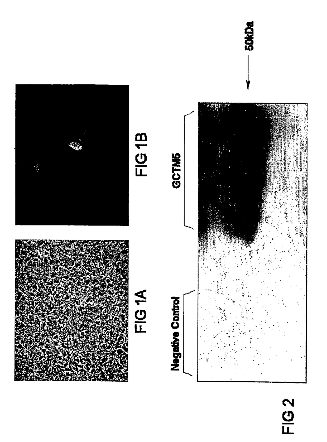 Cell marker for hepatic and pancreatic stem cells and progenitor cells