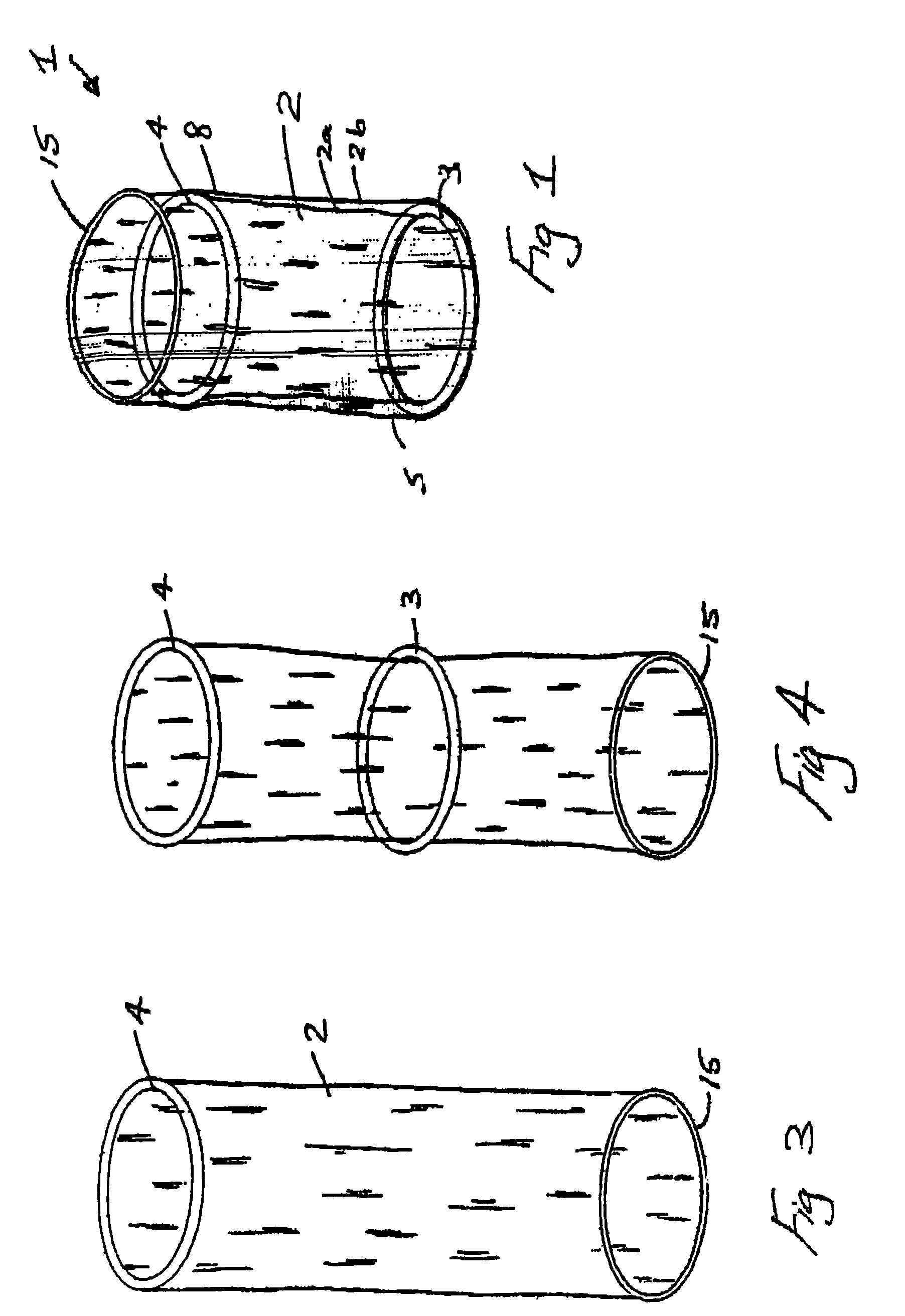 Wound retractor device