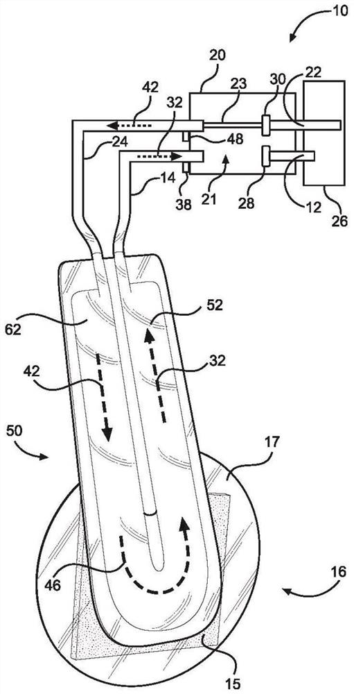 Multi-lumen Bridge for Negative Pressure Wound Therapy Systems