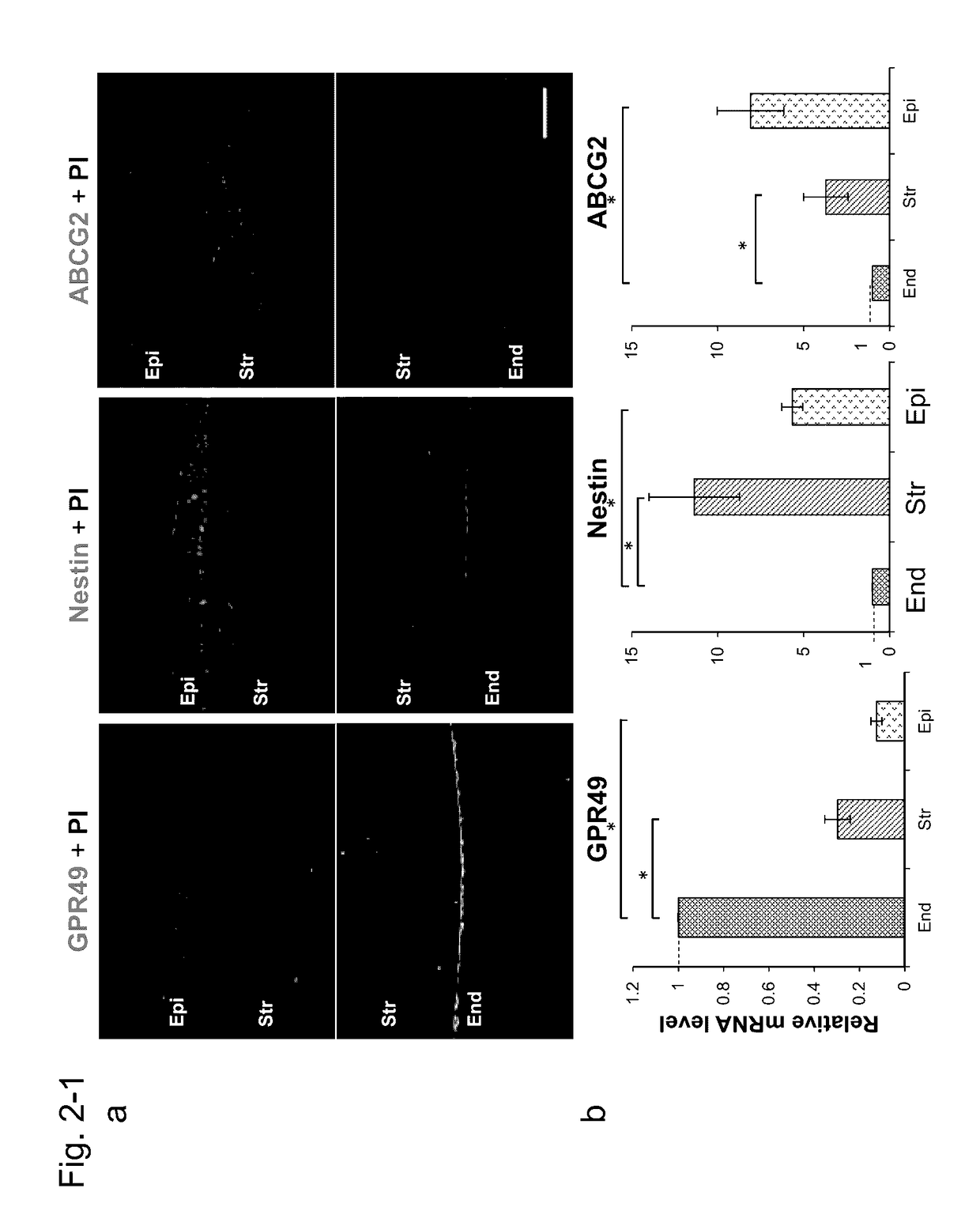 Differentiation marker and differentiation control of eye cell