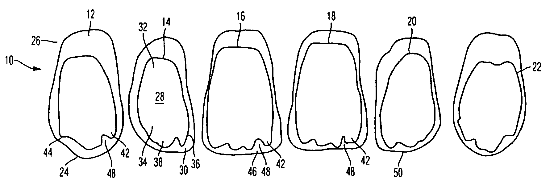 Incisor tooth or canine tooth, and set of teeth, and method for producing and incisor tooth or canine tooth